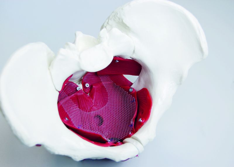 Beckenboden mit Netz