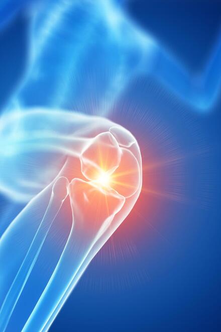 Animation Knie mit roter Schmerzstelle