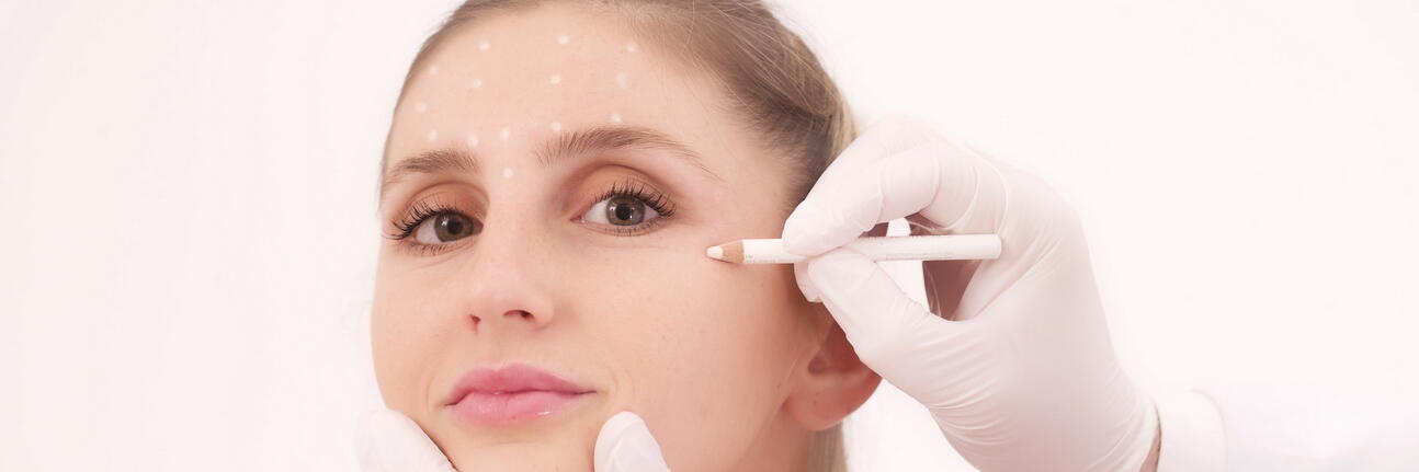 Gesicht einer Frau welches mit einem weißen Stift punktuell markiert wird für Ihre Gesichtshautstraffung