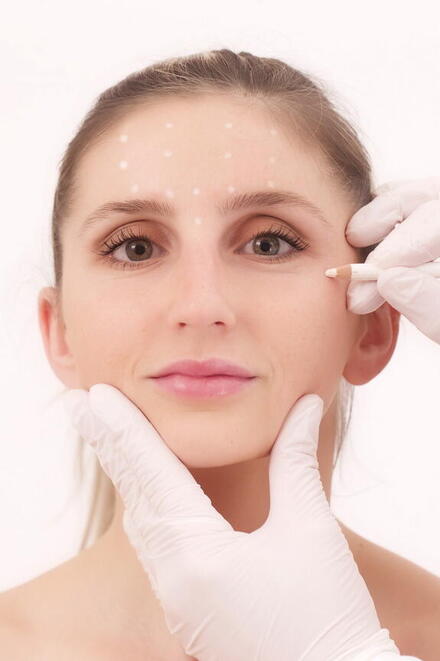 Gesicht einer Frau welches mit einem weißen Stift punktuell markiert wird für Ihren Eingriff