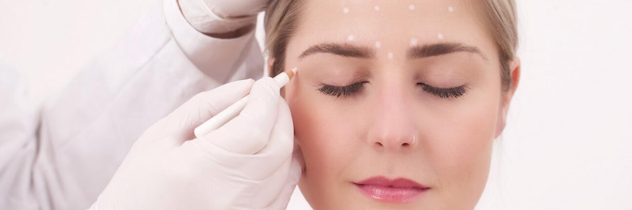 Gesicht einer Frau welches mit einem weißen Stift punktuell markiert wird für Ihren Botox-Eingriff