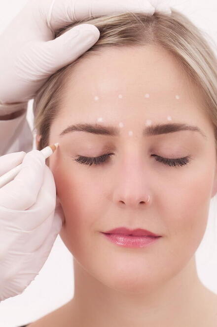 Gesicht einer Frau welches mit einem weißen Stift punktuell markiert wird für Ihren Botox-Eingriff
