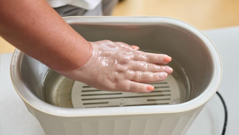 Eine Hand wurde in ein Behältnis mit warmem Paraffin getaucht.